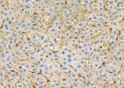 Invitrogen B4GALT4 Polyclonal Antibody 100 &mu;L | Buy Online | Invitrogen&trade; | Fisher Scientific
