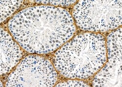 Invitrogen B4GALT4 Polyclonal Antibody 100 &mu;L | Buy Online | Invitrogen&trade; | Fisher Scientific