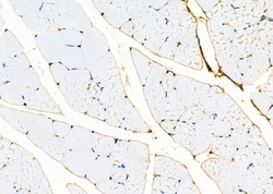 Invitrogen B4GALT4 Polyclonal Antibody 100 &mu;L | Buy Online | Invitrogen&trade; | Fisher Scientific