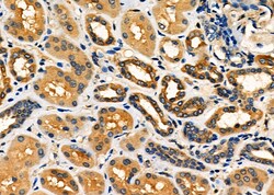 Bmp1 Polyclonal Antibody, Invitrogen 100 &mu;L; Unconjugated:Antibodies,
