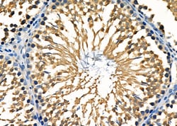 Bmp1 Polyclonal Antibody, Invitrogen 100 &mu;L; Unconjugated:Antibodies,
