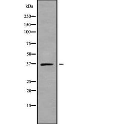 Invitrogen SLC25A14 Polyclonal Antibody 100 &mu;L; Unconjugated:Antibodies,