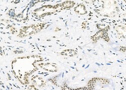 Invitrogen PCP4 Polyclonal Antibody 100 &mu;L; Unconjugated:Antibodies,