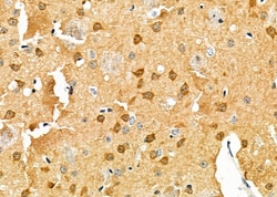 Invitrogen PCP4 Polyclonal Antibody 100 &mu;L; Unconjugated:Antibodies,