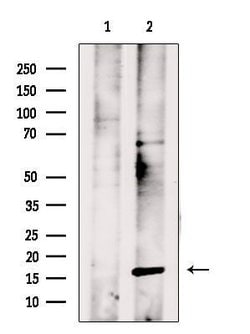 Invitrogen PPP3R1 Polyclonal Antibody 100 &mu;L; Unconjugated:Antibodies,