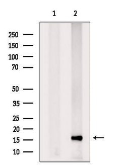 Invitrogen PPP3R1 Polyclonal Antibody 100 &mu;L; Unconjugated:Antibodies,