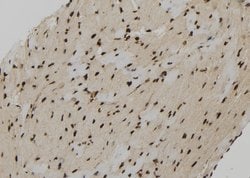 Invitrogen PPP3R2 Polyclonal Antibody 100 &mu;L; Unconjugated:Antibodies,