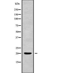 Invitrogen PPP3R2 Polyclonal Antibody 100 &mu;L; Unconjugated:Antibodies,