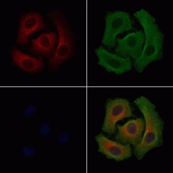 Invitrogen SLC25A13 Polyclonal Antibody 100 &mu;L | Buy Online | Invitrogen&trade; | Fisher Scientific