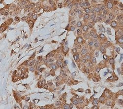 Invitrogen SLC25A13 Polyclonal Antibody 100 &mu;L | Buy Online | Invitrogen&trade; | Fisher Scientific