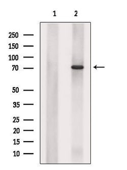 Invitrogen SLC25A13 Polyclonal Antibody 100 &mu;L | Buy Online | Invitrogen&trade; | Fisher Scientific
