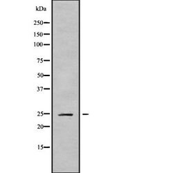 Invitrogen CABP2 Polyclonal Antibody 100 &mu;L; Unconjugated:Antibodies,