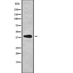 Invitrogen CAB39L Polyclonal Antibody 100 &mu;L | Buy Online | Invitrogen&trade; | Fisher Scientific