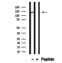 CADPS2 Polyclonal Antibody:Antibodies, Polyclonal