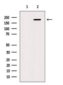 Invitrogen CAMTA1 Polyclonal Antibody 100 &mu;L; Unconjugated:Antibodies,