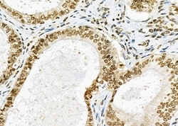 Invitrogen CAMTA2 Polyclonal Antibody 100 &mu;L; Unconjugated:Antibodies,