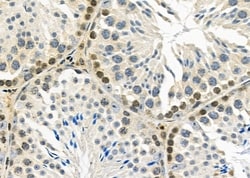 Invitrogen CAMTA2 Polyclonal Antibody 100 &mu;L; Unconjugated:Antibodies,