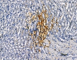 Invitrogen CAPNS2 Polyclonal Antibody 100 &mu;L | Buy Online | Invitrogen&trade; | Fisher Scientific