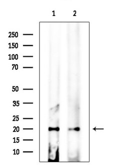 Invitrogen CAPNS2 Polyclonal Antibody 100 &mu;L | Buy Online | Invitrogen&trade; | Fisher Scientific
