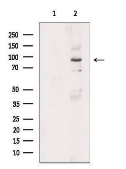 Invitrogen Calpain 3 Polyclonal Antibody 100 &mu;L | Buy Online | Invitrogen&trade; | Fisher Scientific