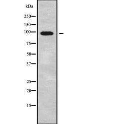 Invitrogen Calpain 7 Polyclonal Antibody 100 &mu;L; Unconjugated:Antibodies,