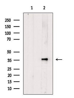 Invitrogen Calponin 3 Polyclonal Antibody 100 &mu;L | Buy Online | Invitrogen&trade; | Fisher Scientific