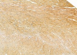 Invitrogen ARPP19 Polyclonal Antibody 100 &mu;L; Unconjugated:Antibodies,