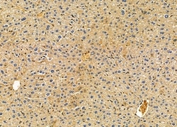 Invitrogen CHST5 Polyclonal Antibody 100 &mu;L; Unconjugated:Antibodies,