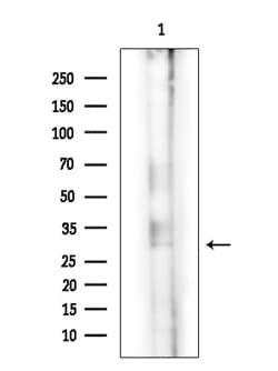 Invitrogen CHST5 Polyclonal Antibody 100 &mu;L; Unconjugated:Antibodies,