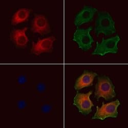 Invitrogen CHST14 Polyclonal Antibody 100 &mu;L; Unconjugated:Antibodies,