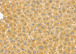 Invitrogen CHST14 Polyclonal Antibody 100 &mu;L; Unconjugated:Antibodies,