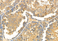 Invitrogen CHST14 Polyclonal Antibody 100 &mu;L; Unconjugated:Antibodies,