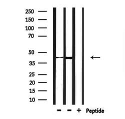 Invitrogen CHST14 Polyclonal Antibody 100 &mu;L; Unconjugated:Antibodies,