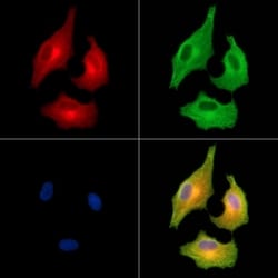 Invitrogen Carbonic Anhydrase XI Polyclonal Antibody 100 &mu;L | Buy Online | Invitrogen&trade; | Fisher Scientific