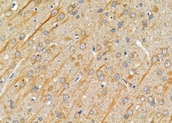 Invitrogen Carbonic Anhydrase XI Polyclonal Antibody 100 &mu;L | Buy Online | Invitrogen&trade; | Fisher Scientific