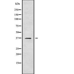 Invitrogen Carbonic Anhydrase XI Polyclonal Antibody 100 &mu;L | Buy Online | Invitrogen&trade; | Fisher Scientific
