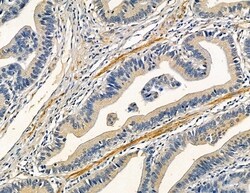 Invitrogen CPXM2 Polyclonal Antibody 100 &mu;L; Unconjugated:Antibodies,