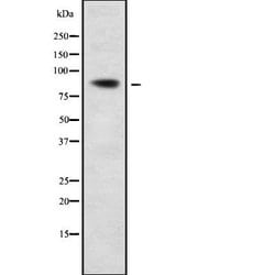 Invitrogen CPXM2 Polyclonal Antibody 100 &mu;L; Unconjugated:Antibodies,