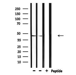 Invitrogen CEACAM16 Polyclonal Antibody 100 &mu;L; Unconjugated:Antibodies,