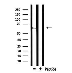 Invitrogen CEACAM20 Polyclonal Antibody 100 &mu;L; Unconjugated:Antibodies,