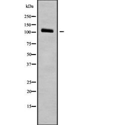 alpha N-Catenin Polyclonal Antibody 100 &mu;L | Buy Online | Thermo Scientific | Fisher Scientific