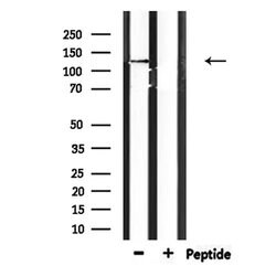 Invitrogen Catenin delta-2 Polyclonal Antibody 100 &mu;L; Unconjugated:Antibodies,