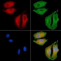 Invitrogen CATSPER1 Polyclonal Antibody 100 &mu;L; Unconjugated:Antibodies,