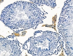 Invitrogen CATSPER1 Polyclonal Antibody 100 &mu;L; Unconjugated:Antibodies,