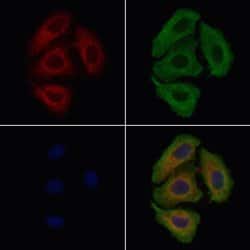 Invitrogen CATSPER3 Polyclonal Antibody 100 &mu;L; Unconjugated:Antibodies,