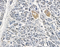 Invitrogen CATSPERB Polyclonal Antibody 100 &mu;L; Unconjugated:Antibodies,