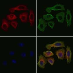 Invitrogen CHAC1 Polyclonal Antibody 100 &mu;L; Unconjugated:Antibodies,