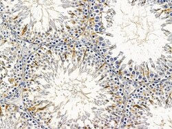 Invitrogen CHAC1 Polyclonal Antibody 100 &mu;L; Unconjugated:Antibodies,