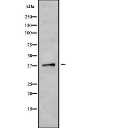 CGRRF1 Polyclonal Antibody, Invitrogen 100 &mu;L; Unconjugated:Antibodies,