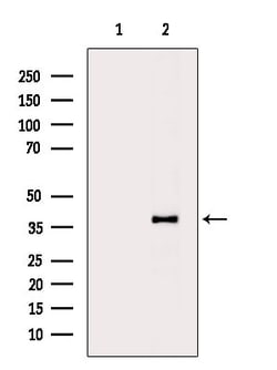 CGRRF1 Polyclonal Antibody, Invitrogen 100 &mu;L; Unconjugated:Antibodies,